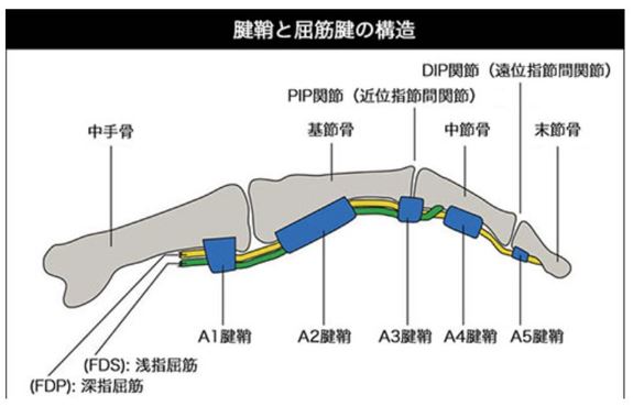 ばね指(指の腱鞘炎) | 市川市 i-care整骨院 南行徳院・行徳駅前院